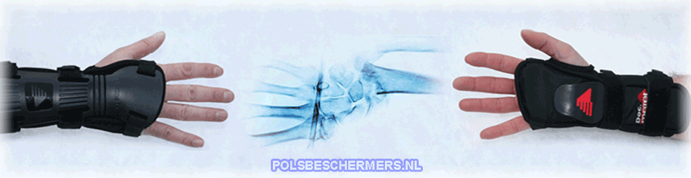 Polsbeschermer Polsbeschermer